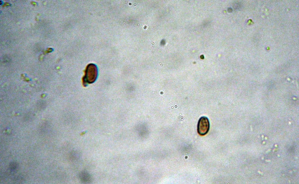 Inocybe (forse) con micro